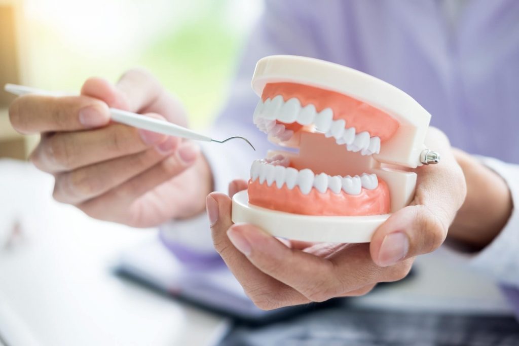 Five Steps to Take to Prevent Tooth Decay in Sterling Heights