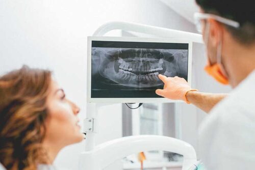 What Kind of Dental Problems can be Detected by Dental X-Rays?