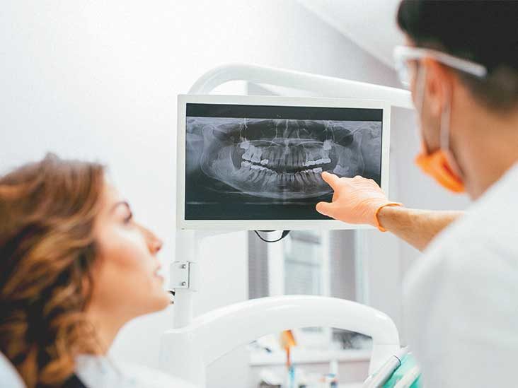 What Kind of Dental Problems can be Detected by Dental X-Rays?