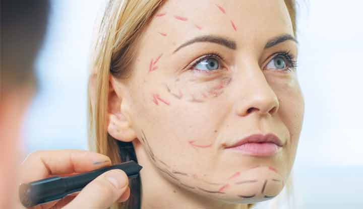 Revive and Renew: Experience the Magic of RF Microneedling