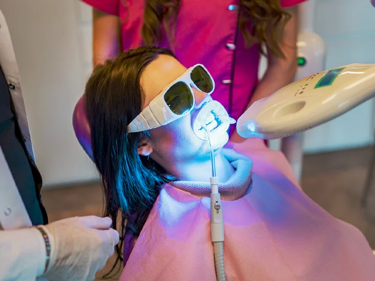 5 Reasons to Consider Teeth Whitening