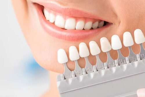 The Importance of Finding the Right Cosmetic Dentist in Fresno