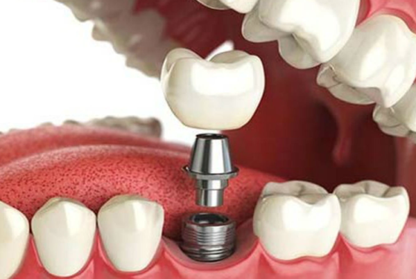 What are the most common prosthodontic treatments?