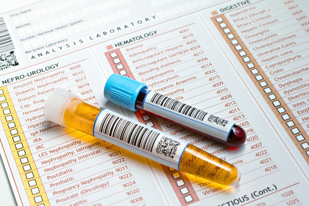 What are the Common Ways of Testing for Drugs and Alcohol?