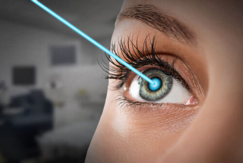 What Makes LASIK a Popular Choice?