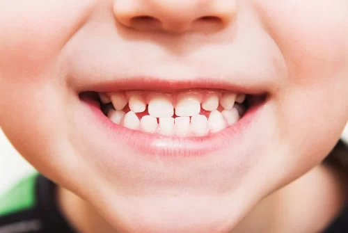 The Importance of Primary Teeth: Why Baby Teeth Matter