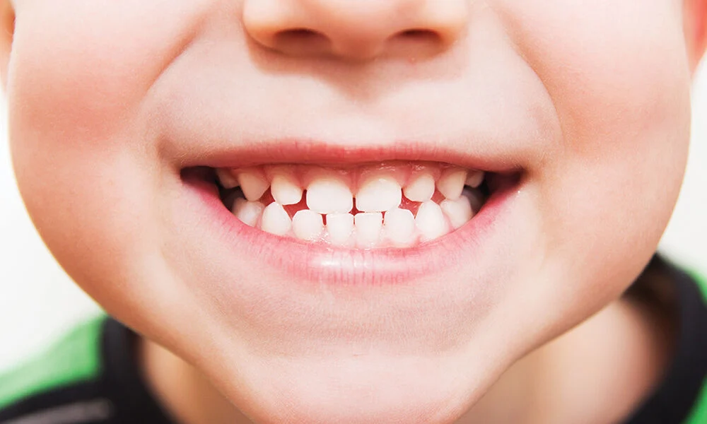 The Importance of Primary Teeth: Why Baby Teeth Matter