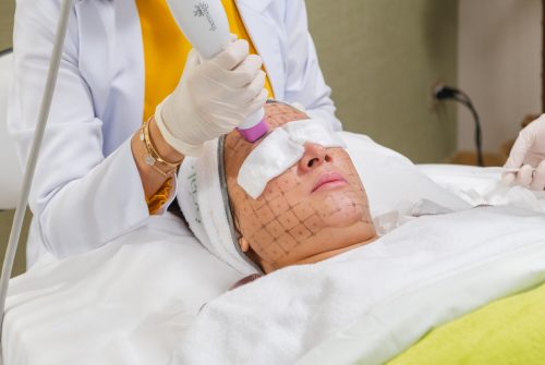 How Does the Thermage FLX Treatment Enhance Skin Health?