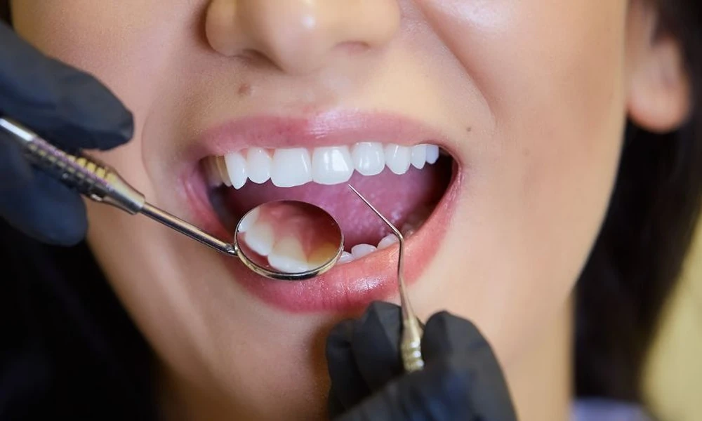 3 Ways Preventive Dentistry Reduces The Risk Of Dental Emergencies